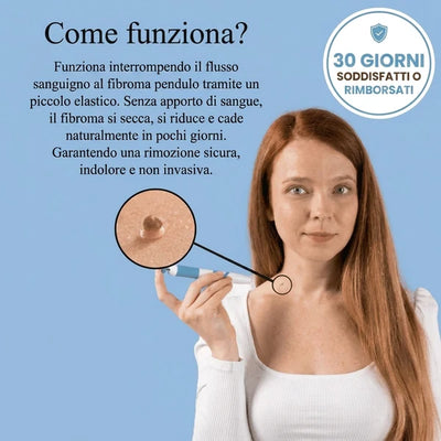Kit di Rimozione dei Fibromi Penduli