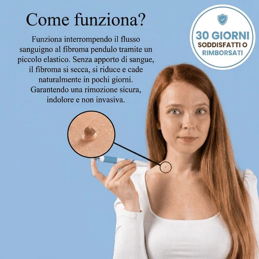 Kit di Rimozione dei Fibromi Penduli